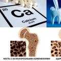 Calcium for pregnant women: daily requirement, deficiency, sources of calcium